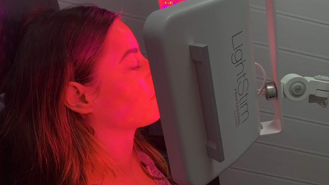 clinical microneedling treatment review