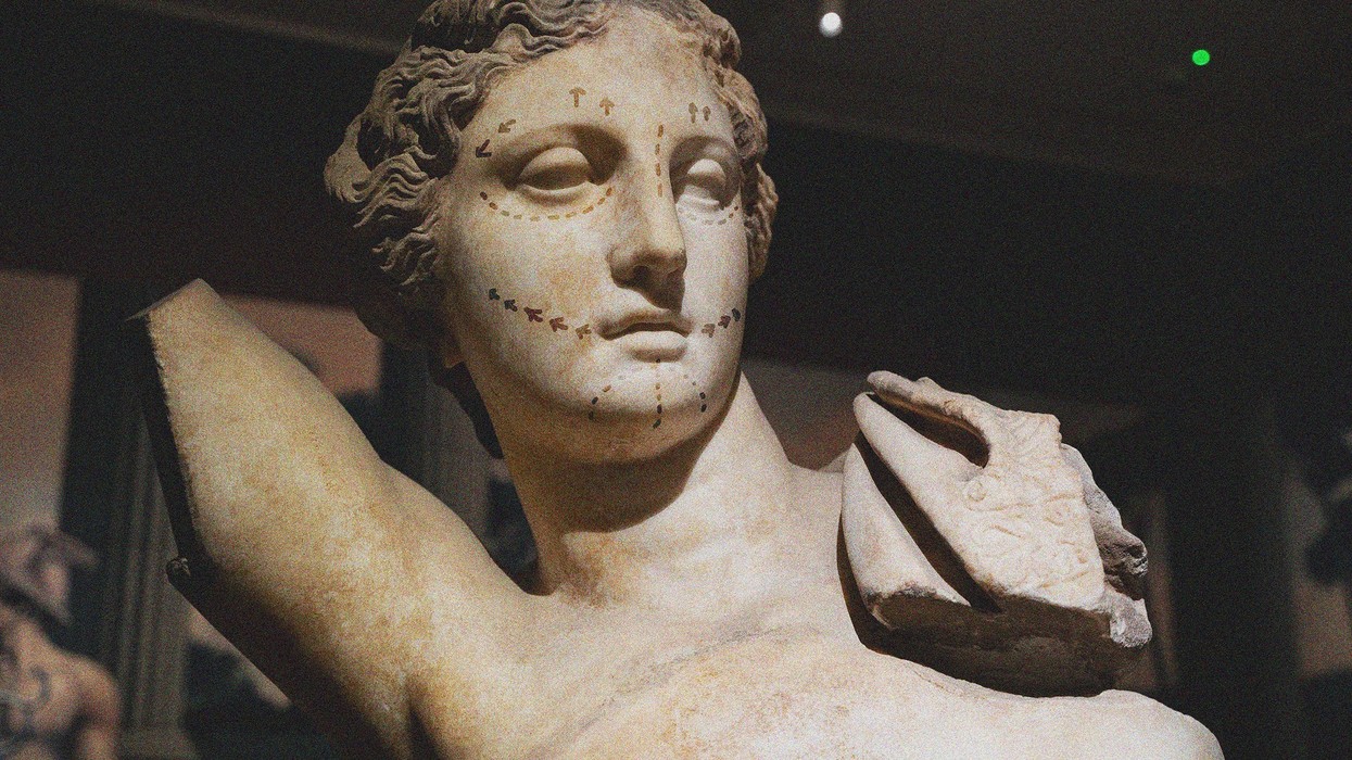 What Happened To Instagram Face?