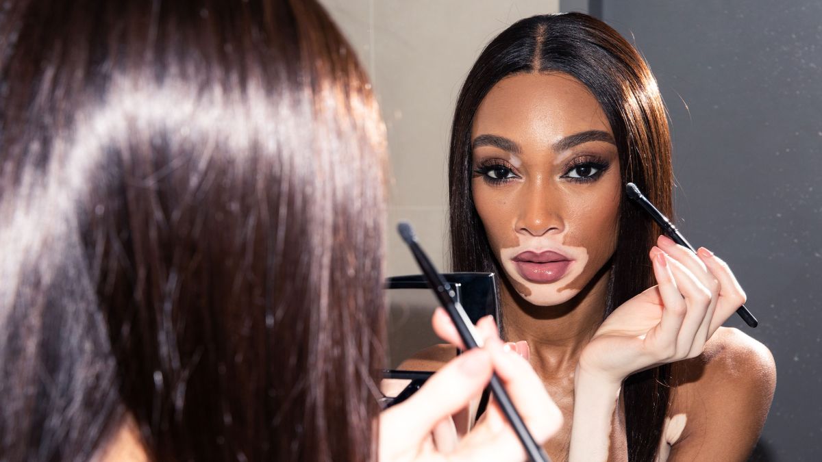 winnie harlow