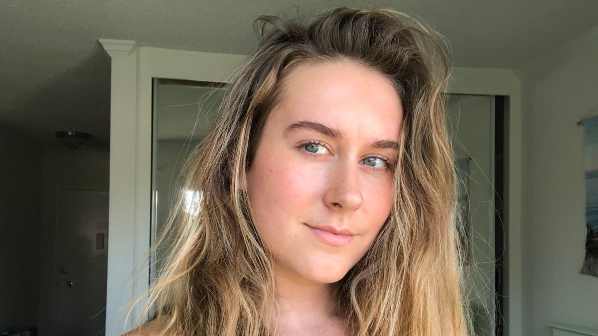 under eye circles