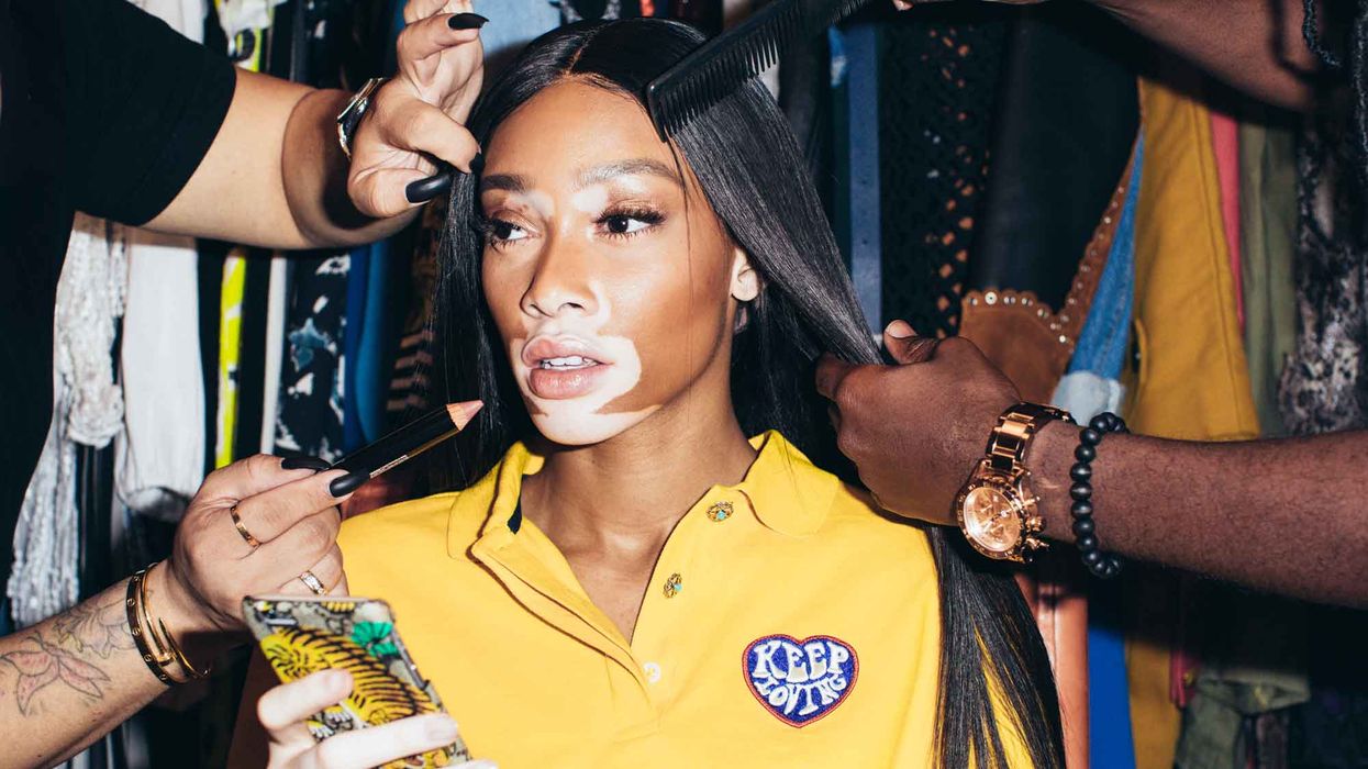 Winnie Harlow on the One Thing She Can’t Stop Screen Grabbing
