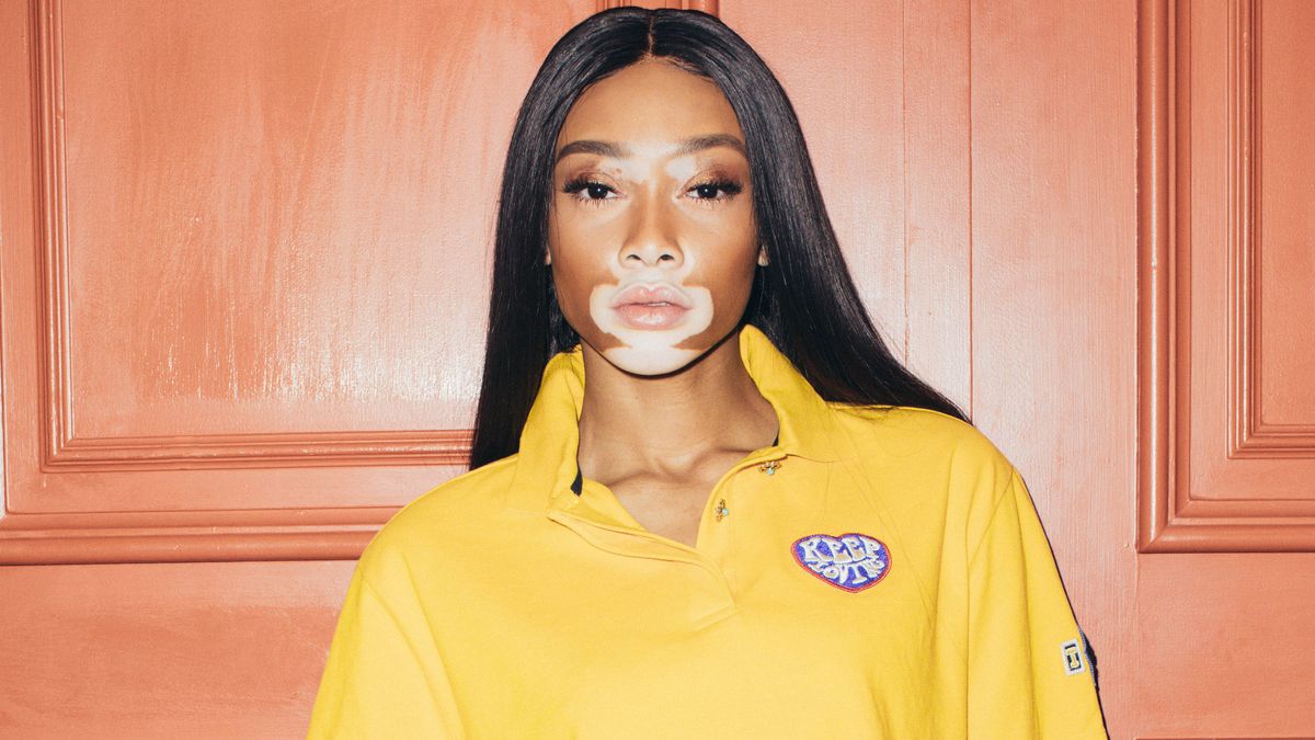 Winnie Harlow Doesn’t Want to Be Defined By Her Skin