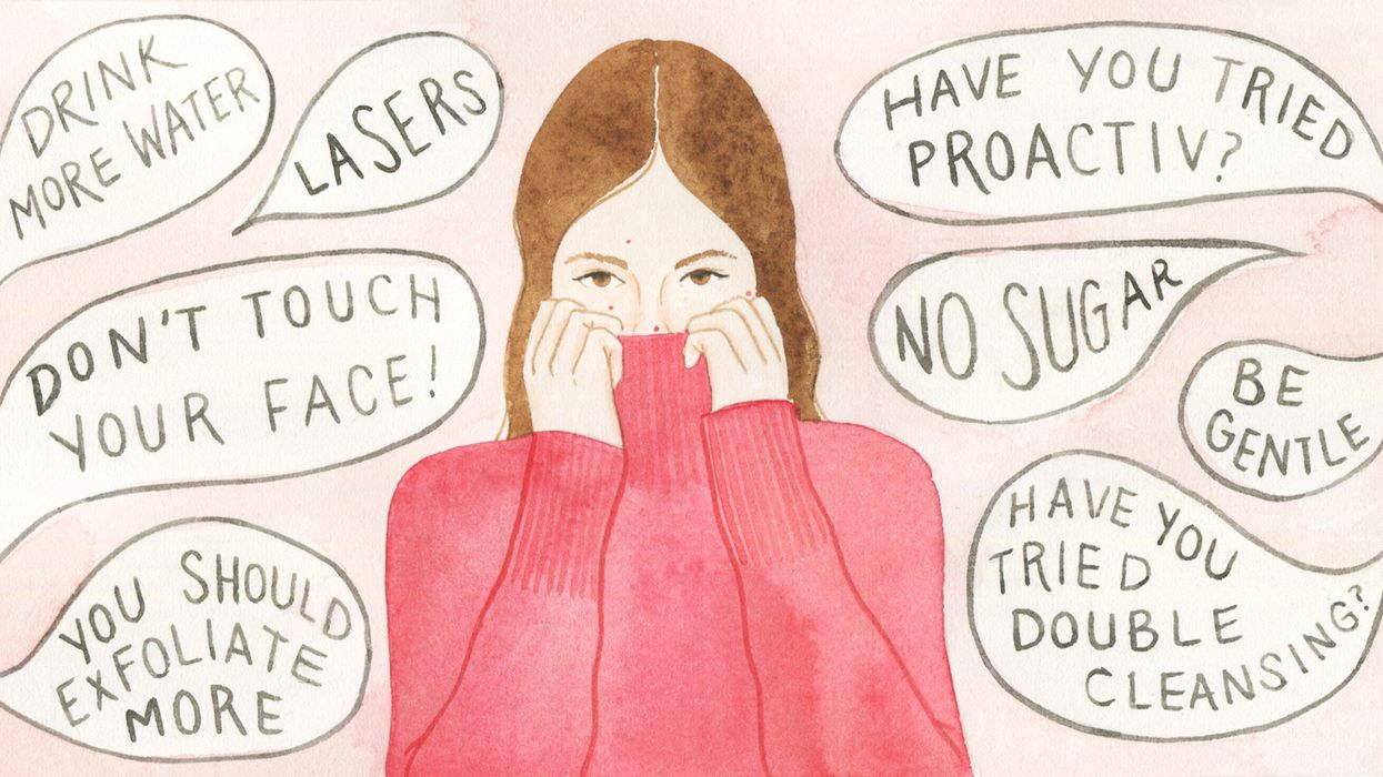 How I Finally Kicked My Adult Acne Problem