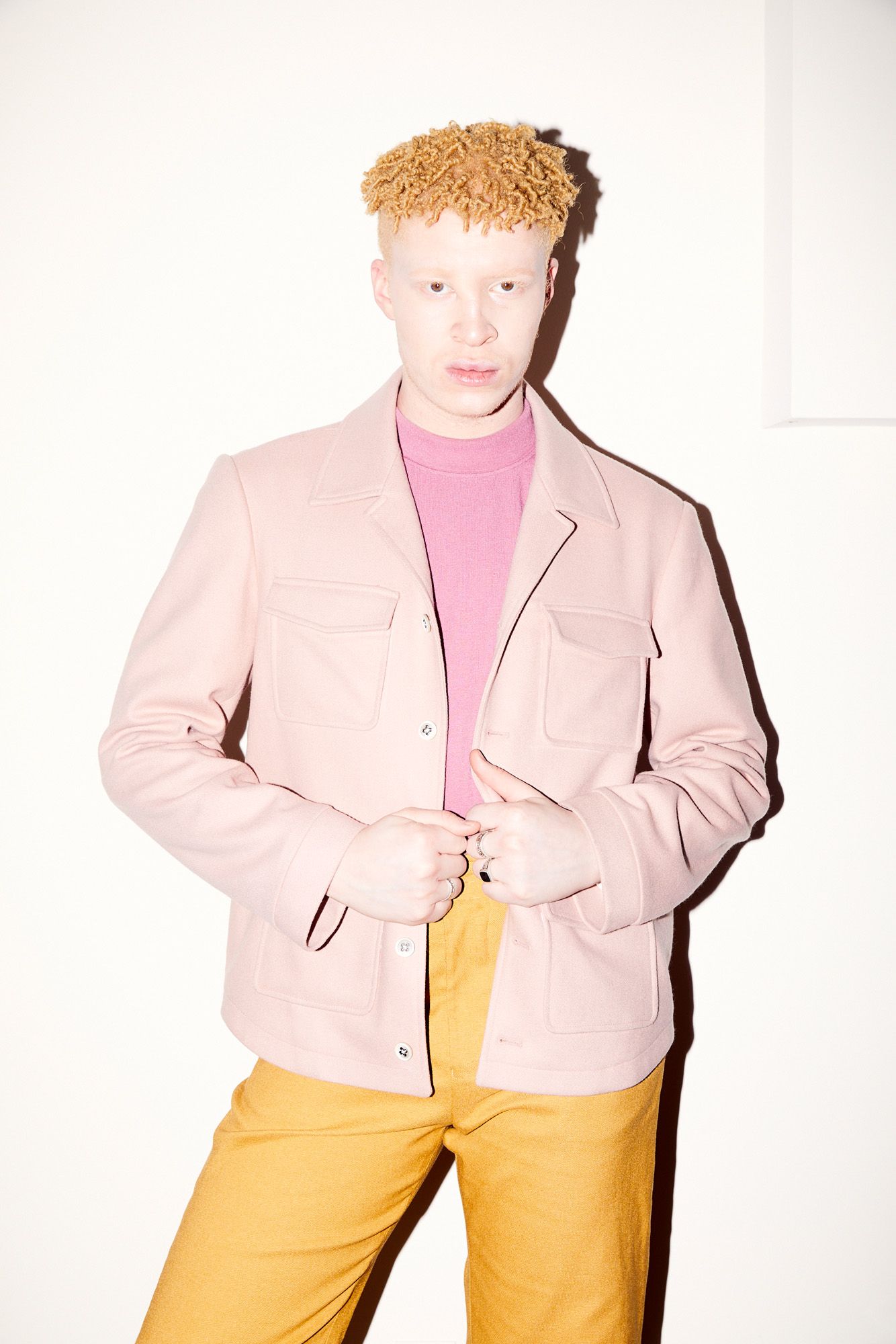 Shaun albino model nose