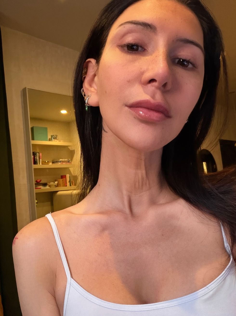 \u200bBefore Lyma Laser Pro