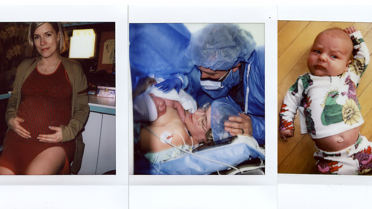 gentle c-section